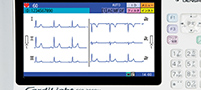 携帯型心電図